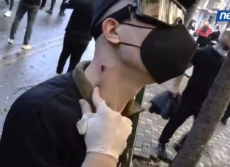 Pamje të rënda vijnë nga protesta te Rruga e Durrësit